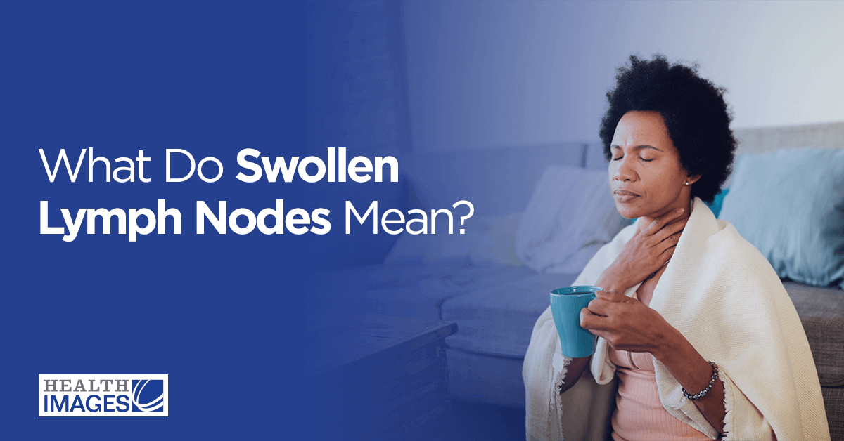 swollen lymph nodes in neck cancer