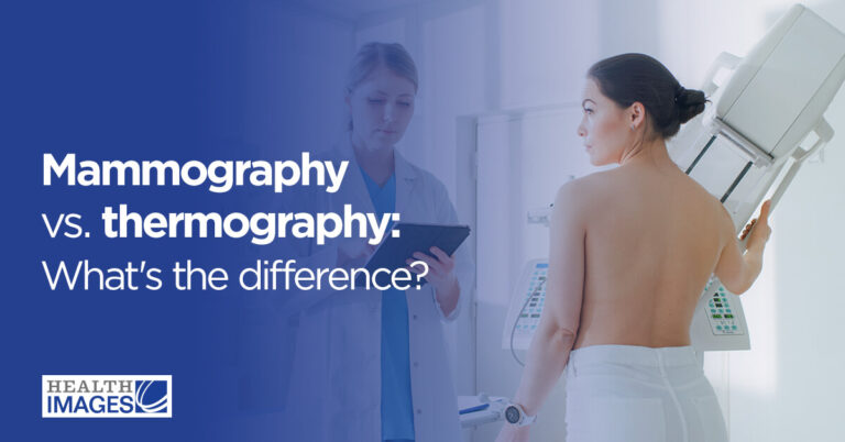 Mammography vs. thermography: What's the difference? - Health Images