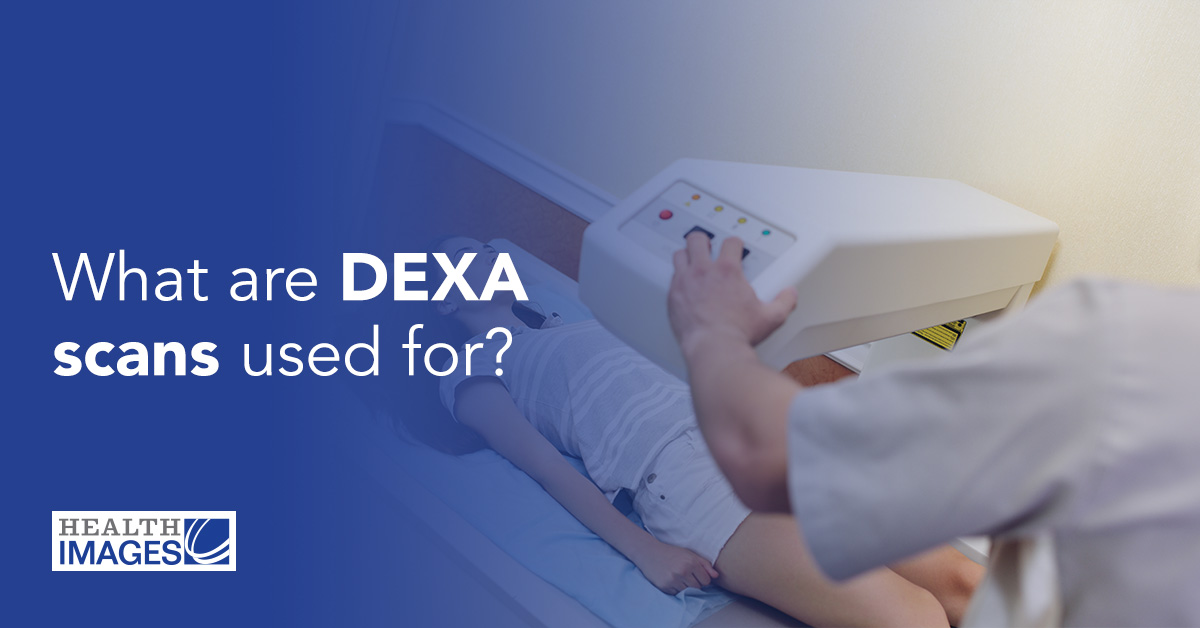 What are DEXA scans used for?