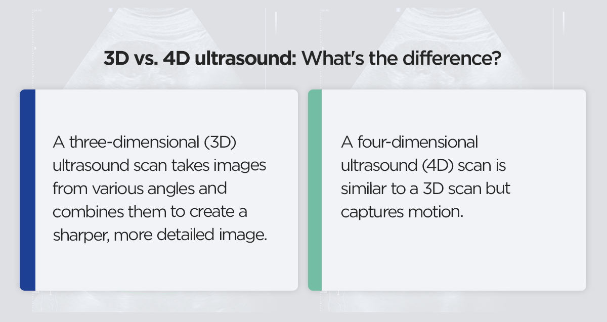 3D vs. 4D ultrasound: What's the difference?